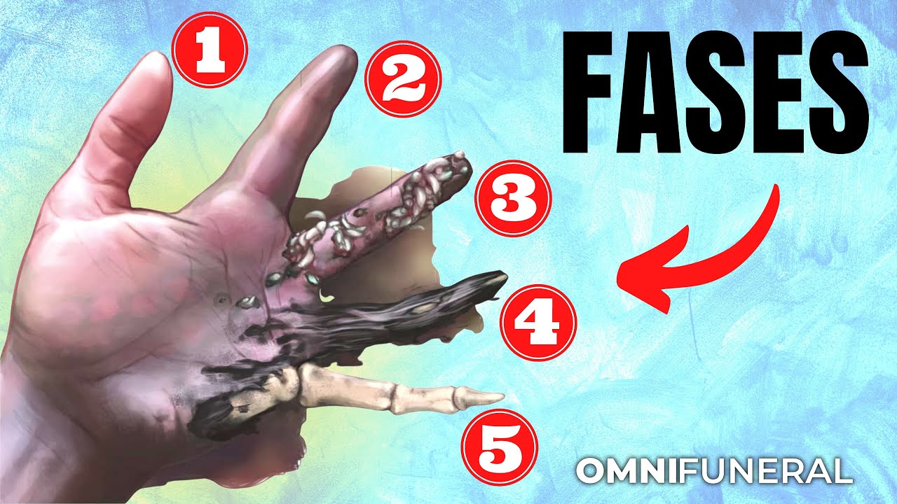 como esta un cadaver despues de un año