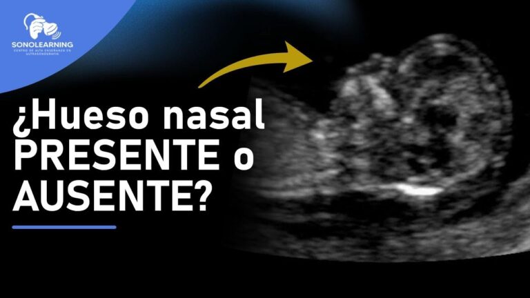 cuando se forma la nariz del feto