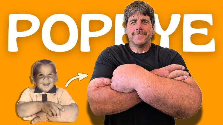 hombre con las manos mas grandes del mundo